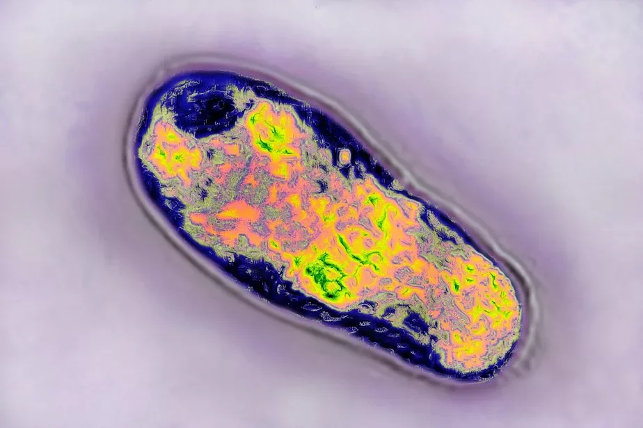Бактериальная инфекция Brucella, которая обычно наблюдается у животных и вызывает у них бесплодие. Фото: BSIP / Contributor Getty Images